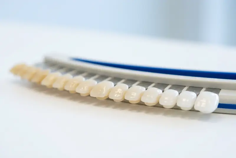 Guía de color dental con muestras de tonos para medir el resultado de un blanqueamiento