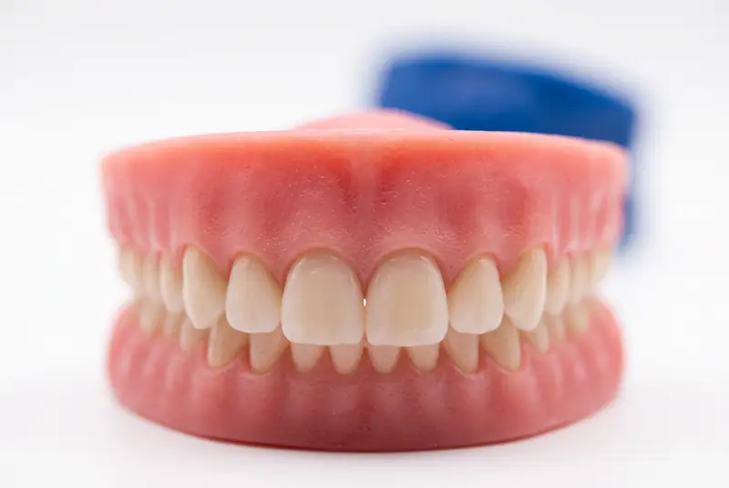 Modelo dental con encía de silicona rosada que muestra la proporción entre la encía y la corona de los dientes superiores